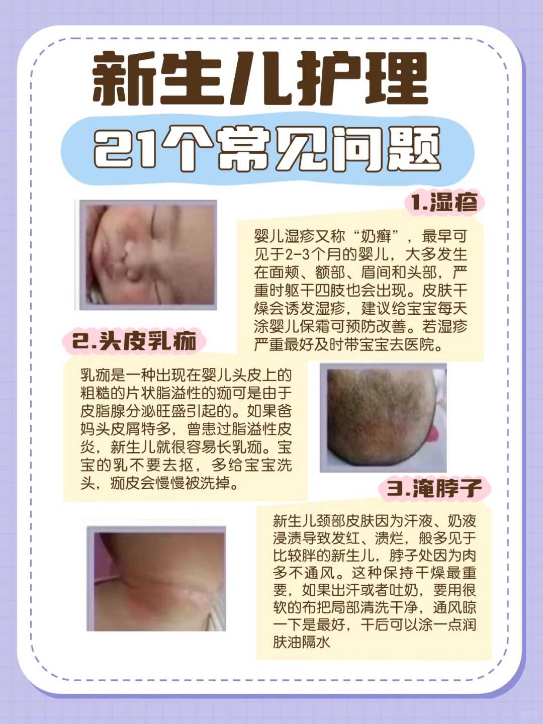 预防孕期早产有技巧 建议准妈妈们来看一看