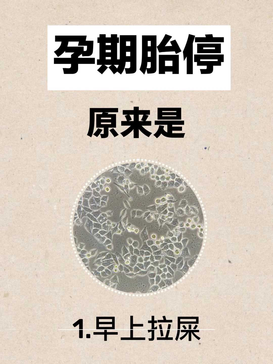 深圳怀生国际做三代试管婴儿怎么样？