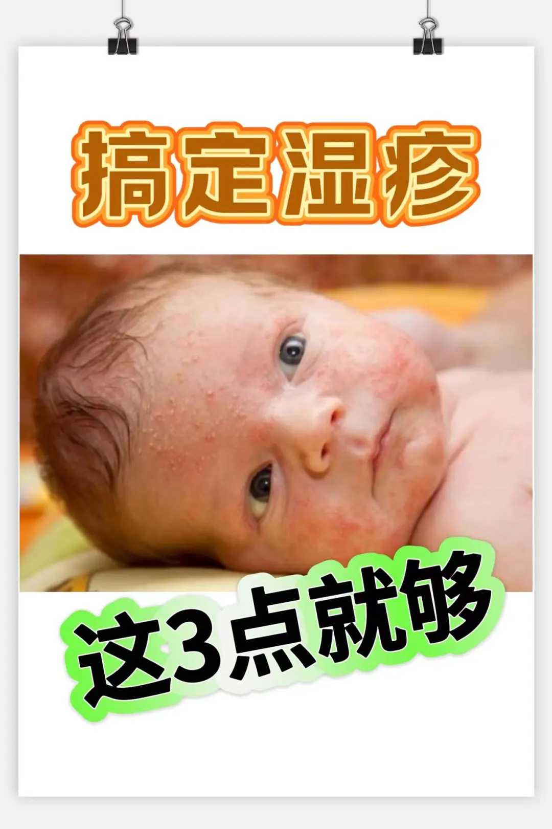 小月子会落下月子病吗？注意这些细节可以预防